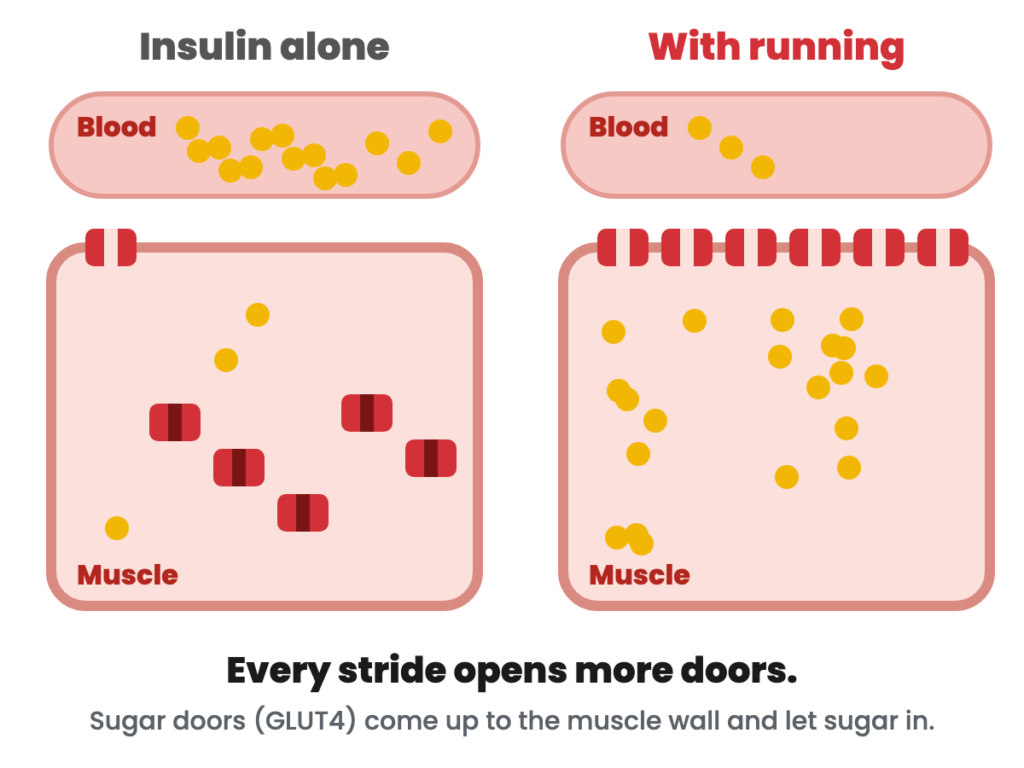 Two leg muscles side by side: insulin alone opens one sugar door, running opens every door and fills the muscle with sugar.